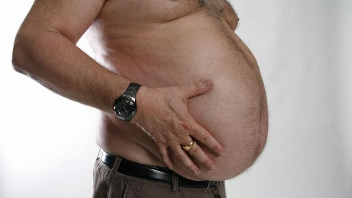 A obesidade como causa do desenvolvemento de varices