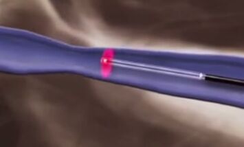 Tratamentos térmicos